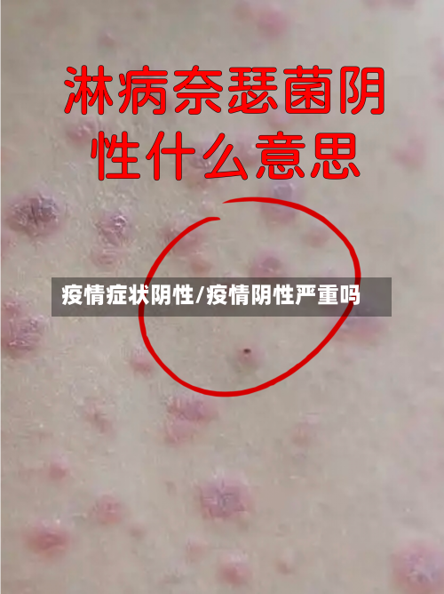 疫情症状阴性/疫情阴性严重吗-第3张图片