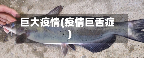 巨大疫情(疫情巨舌症)-第2张图片