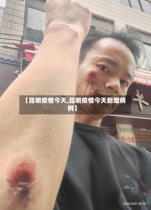【昆明疫情今天,昆明疫情今天新增病例】